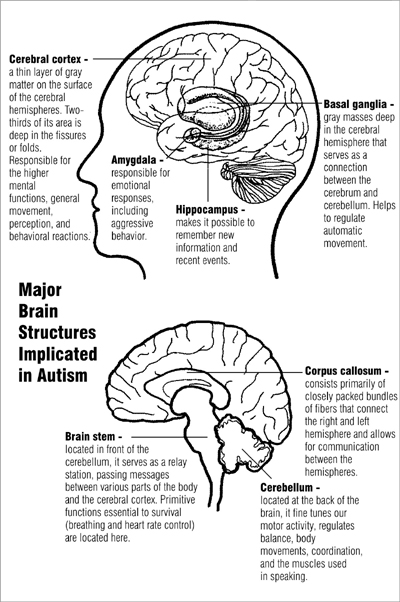 Image of major brain structures implicated in autism